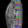 Automatic Segmentation, Localization and Identification of Vertebrae in 3D CT Images Using Cascaded Convolutional Neural Networks